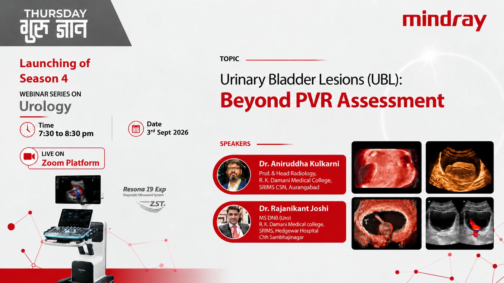 Beyond PVR Assesment